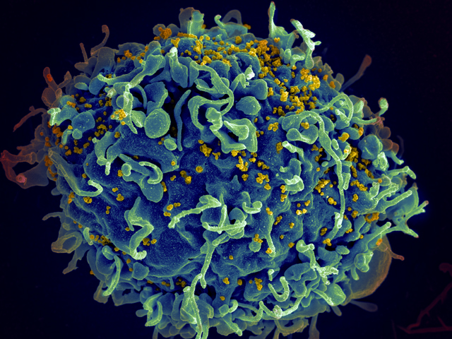 Virus HIV tồn tại trên các tế bào T, nhưng nó cũng có thể tồn tại tương tự trong đại thực bào